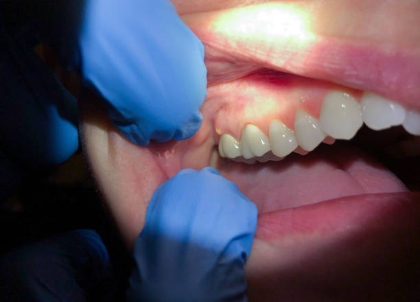 Best Walk-In Emergency Dental Services in Golden Valley, AZ
